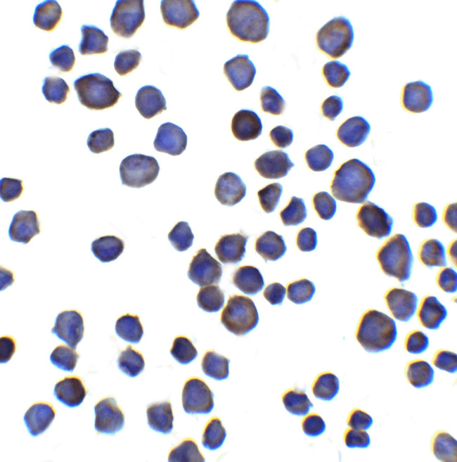 CHAD Antibody in Immunocytochemistry (ICC/IF)