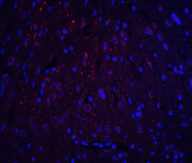 HOOK3 Antibody in Immunohistochemistry (Paraffin) (IHC (P))