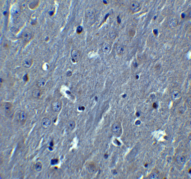 HOOK3 Antibody in Immunohistochemistry (Paraffin) (IHC (P))