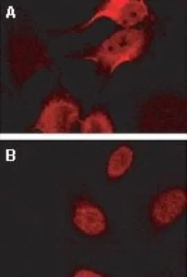 BAG2 Antibody in Immunocytochemistry (ICC/IF)