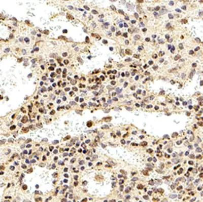 DEDD2 Antibody in Immunohistochemistry (Paraffin) (IHC (P))