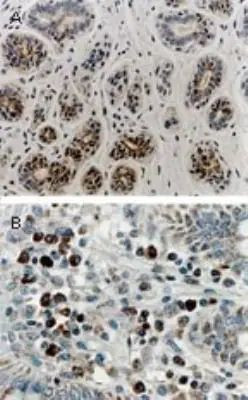 RIP1 Antibody in Immunohistochemistry (Paraffin) (IHC (P))