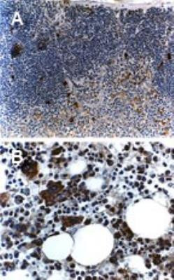 TRAF5 Antibody in Immunohistochemistry (Paraffin) (IHC (P))