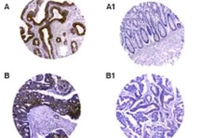 CARD8 Antibody in Immunohistochemistry (Paraffin) (IHC (P))