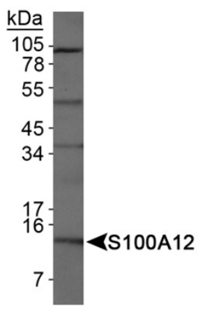 S100A12 Antibody in Western Blot (WB)