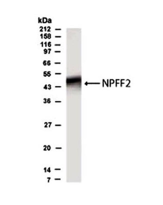 NPFF2 Antibody in Western Blot (WB)