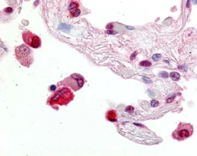 ABCG1 Antibody in Immunohistochemistry (Paraffin) (IHC (P))