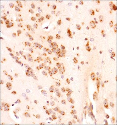 GLI1 Antibody in Immunohistochemistry (Paraffin) (IHC (P))