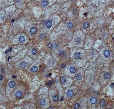 ENPP1 Antibody in Immunohistochemistry (Paraffin) (IHC (P))