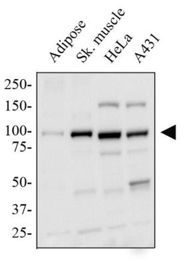 PPARGC1A Antibody in Western Blot (WB)