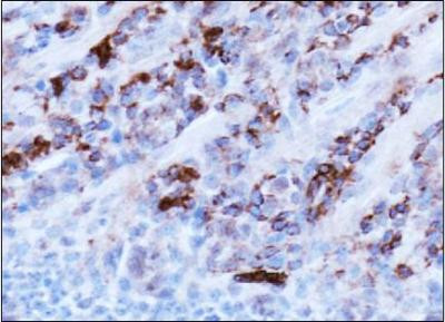 AMBRA1 Antibody in Immunohistochemistry (Paraffin) (IHC (P))