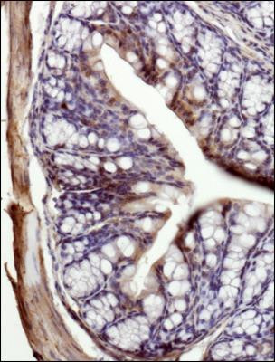 MCT1 Antibody in Immunohistochemistry (Paraffin) (IHC (P))