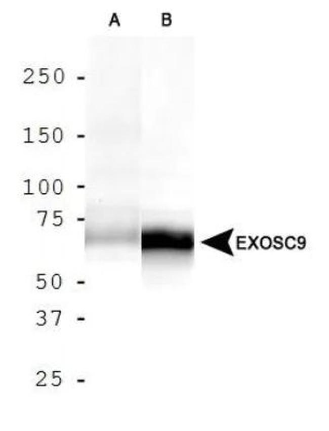 PMSCL1 Antibody in Western Blot (WB)