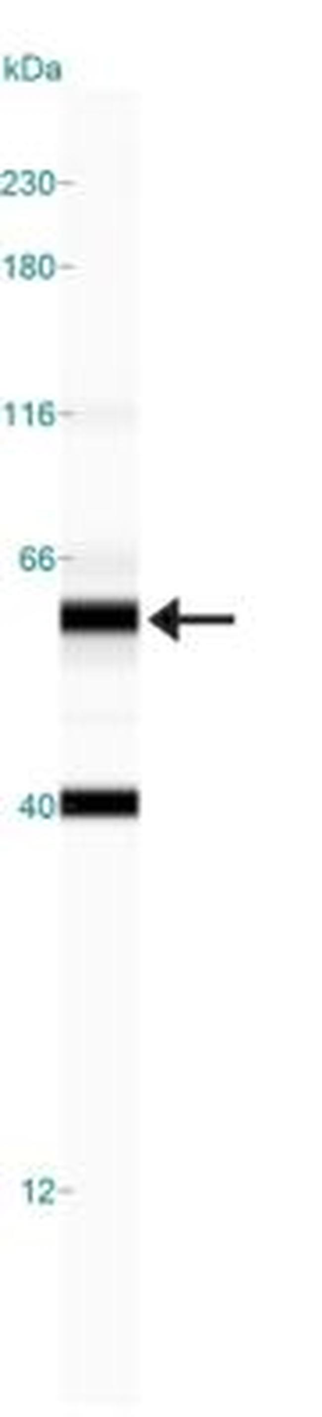 GLS2 Antibody in Western Blot (WB)