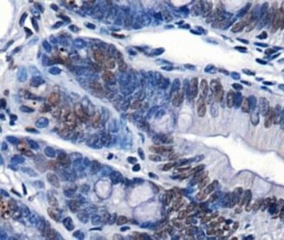 CHD7 Antibody in Immunohistochemistry (Paraffin) (IHC (P))