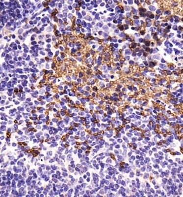 ABCB5 Antibody in Immunohistochemistry (Paraffin) (IHC (P))