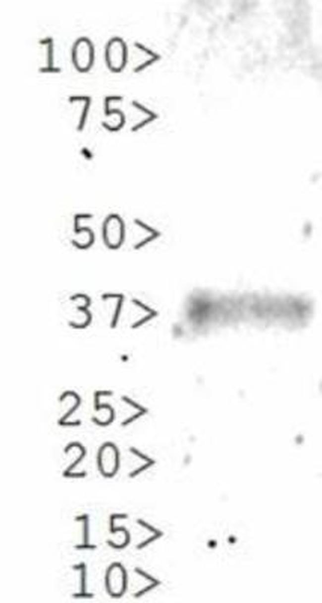 GLI1 Antibody in Western Blot (WB)