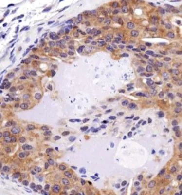 FAT4 Antibody in Immunohistochemistry (Paraffin) (IHC (P))