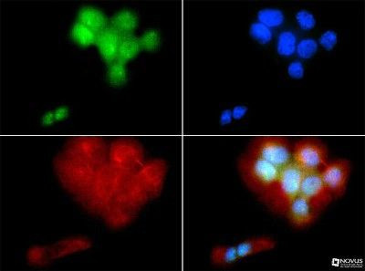 PIEZO2 Antibody in Immunocytochemistry (ICC/IF)