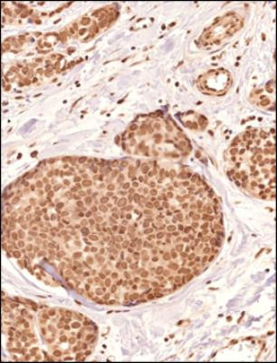 PIEZO2 Antibody in Immunohistochemistry (Paraffin) (IHC (P))