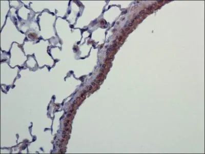 NLRC4 Antibody in Immunohistochemistry (Paraffin) (IHC (P))