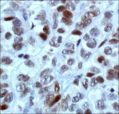 MBD4 Antibody in Immunohistochemistry (Paraffin) (IHC (P))