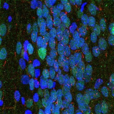 Adenylate Cyclase 3 Antibody in Immunocytochemistry (ICC/IF)