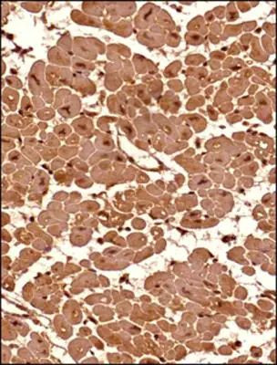 SETX Antibody in Immunohistochemistry (Paraffin) (IHC (P))