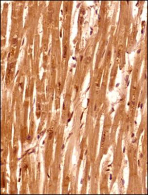 SETX Antibody in Immunohistochemistry (Paraffin) (IHC (P))