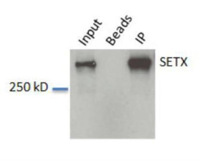 SETX Antibody in Western Blot (WB)