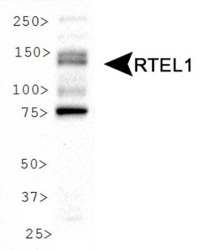 RTEL1 Antibody in Western Blot (WB)