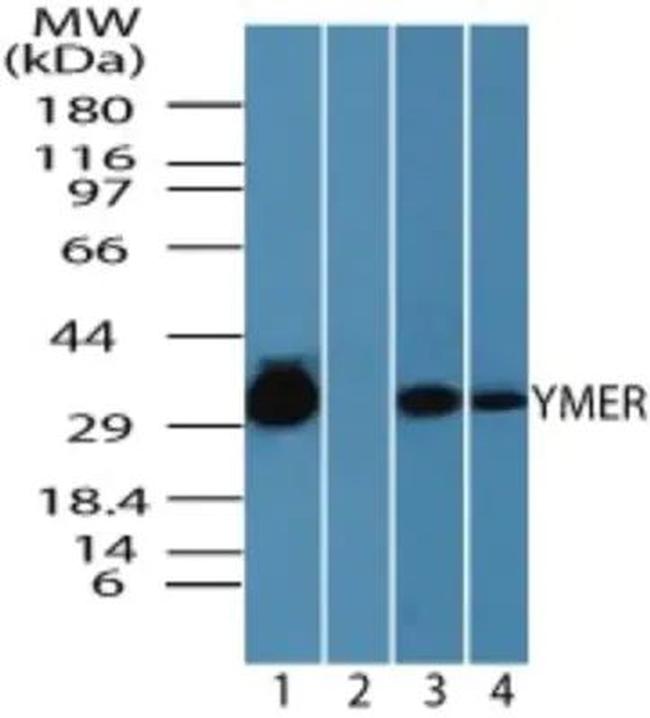 Ymer Antibody in Western Blot (WB)