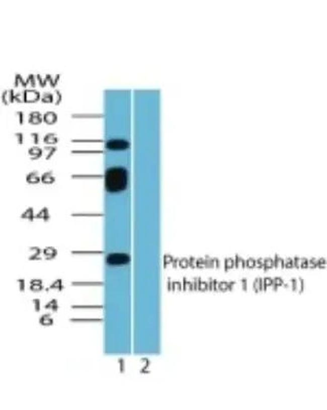 PPP1R1A Antibody in Western Blot (WB)