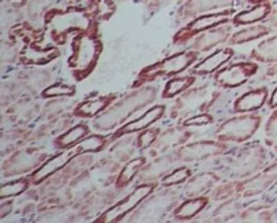 SAMHD1 Antibody in Immunohistochemistry (Paraffin) (IHC (P))