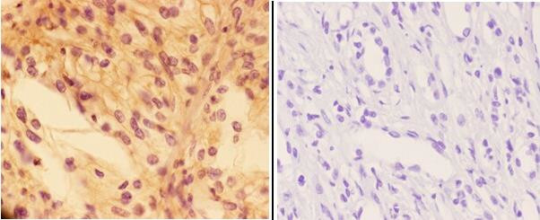 PTPRO Antibody in Immunohistochemistry (Paraffin) (IHC (P))