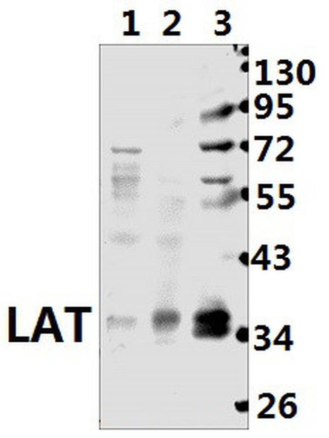 LAT Antibody in Western Blot (WB)