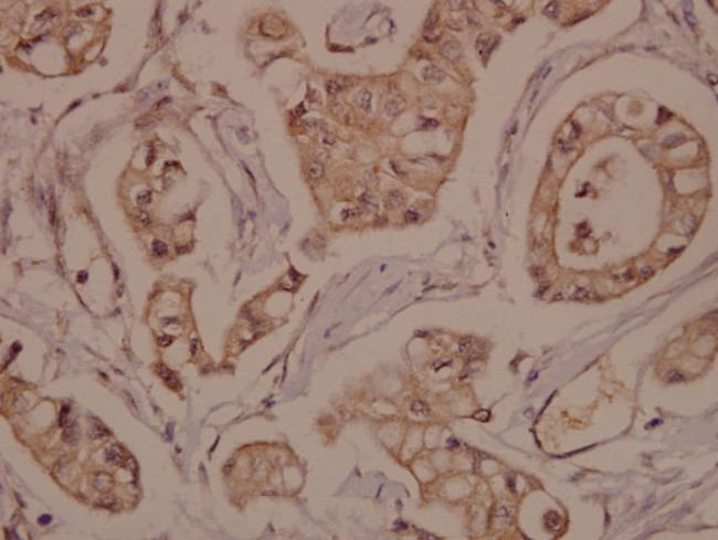 RPH3A Antibody in Immunohistochemistry (Paraffin) (IHC (P))