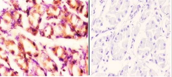 RAD52 Antibody in Immunohistochemistry (Paraffin) (IHC (P))