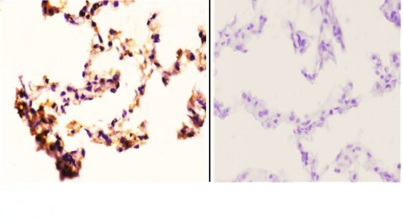 RAD52 Antibody in Immunohistochemistry (Paraffin) (IHC (P))