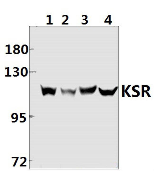 KSR1 Antibody in Western Blot (WB)