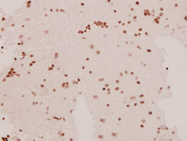 SAPAP1 Antibody in Immunohistochemistry (Paraffin) (IHC (P))