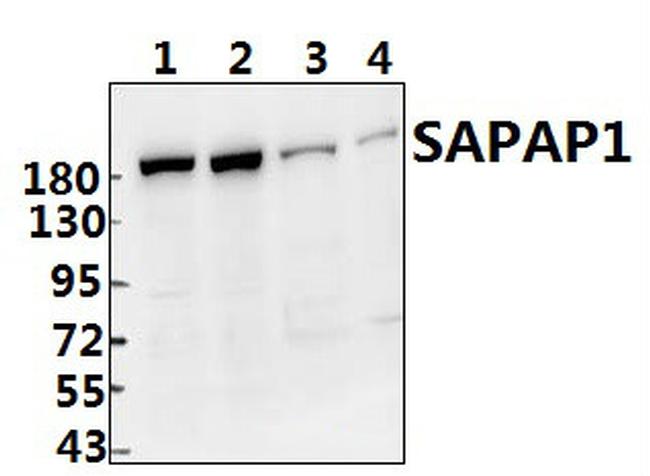 SAPAP1 Antibody in Western Blot (WB)