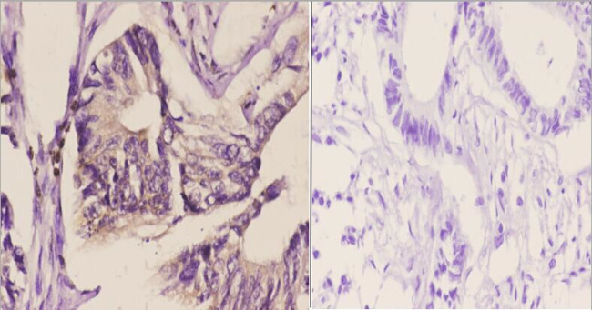 C/EBP delta/epsilon Antibody in Immunohistochemistry (Paraffin) (IHC (P))