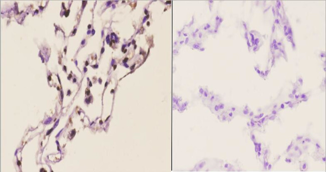 C/EBP delta/epsilon Antibody in Immunohistochemistry (Paraffin) (IHC (P))