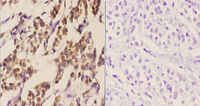 C/EBP delta/epsilon Antibody in Immunohistochemistry (Paraffin) (IHC (P))