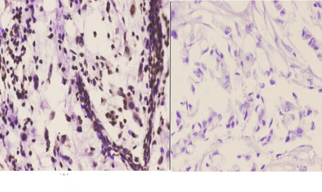 C/EBP delta/epsilon Antibody in Immunohistochemistry (Paraffin) (IHC (P))