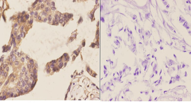 NCBP2 Antibody in Immunohistochemistry (Paraffin) (IHC (P))