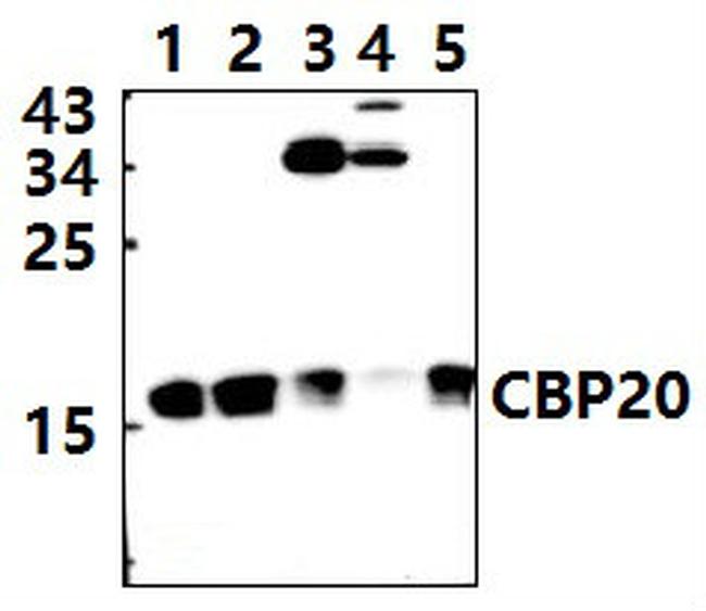 NCBP2 Antibody in Western Blot (WB)