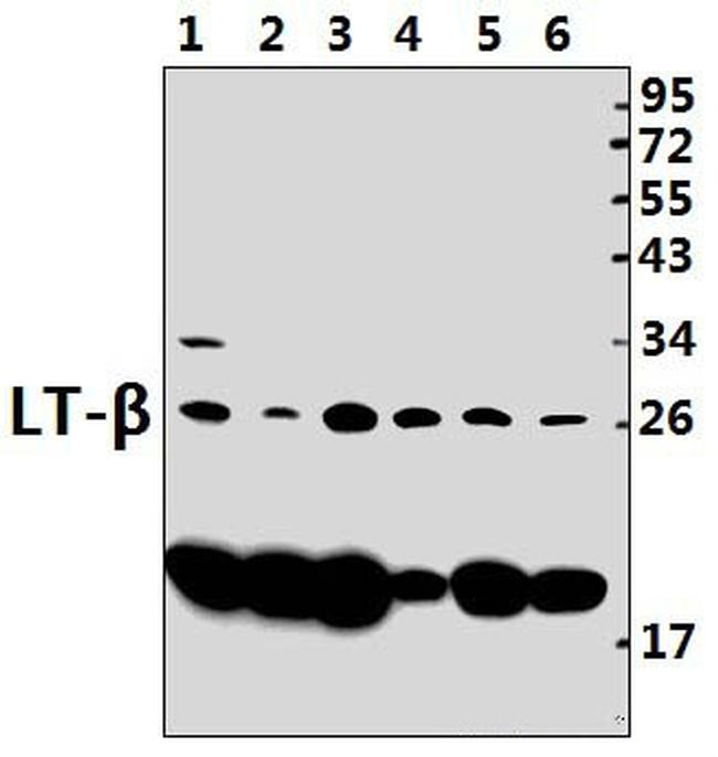 LTB Antibody in Western Blot (WB)