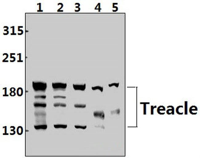 TCOF1 Antibody in Western Blot (WB)